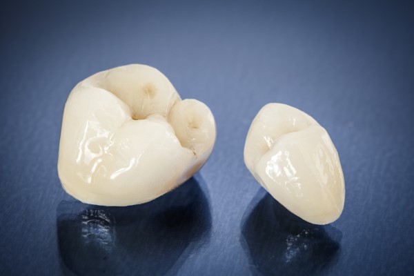 What Is A Dental Crown And When Do You Need One?