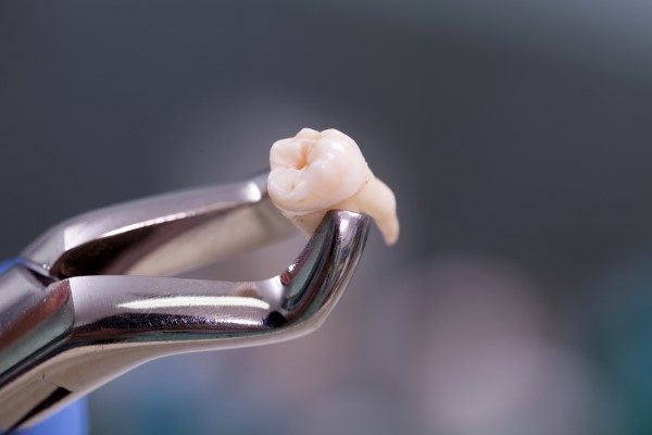 General Dentistry Quick Guide For Tooth Extraction Aftercare